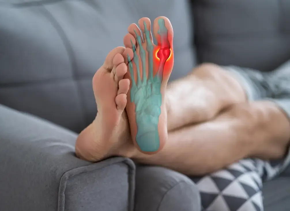 A foot resting on a couch with the big toe joint highlighted
