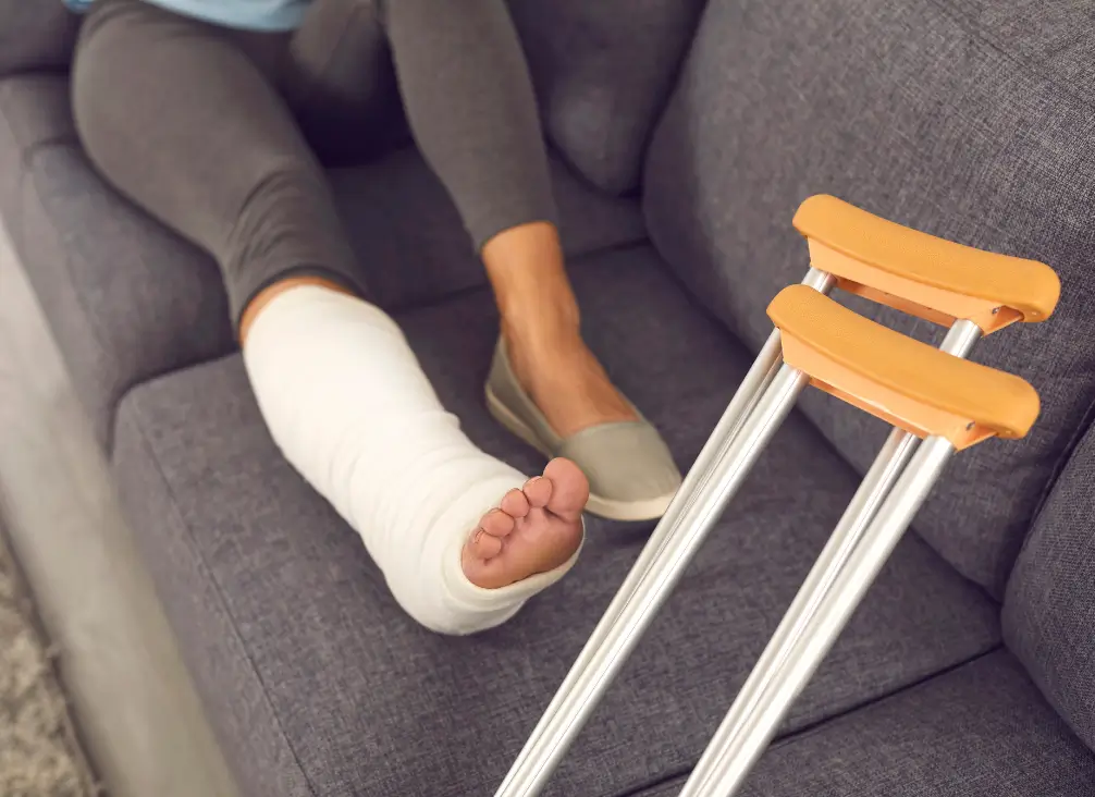 Woman with leg in plaster cast resting on couch – podiatry Brunswick care for foot and ankle fractures.
