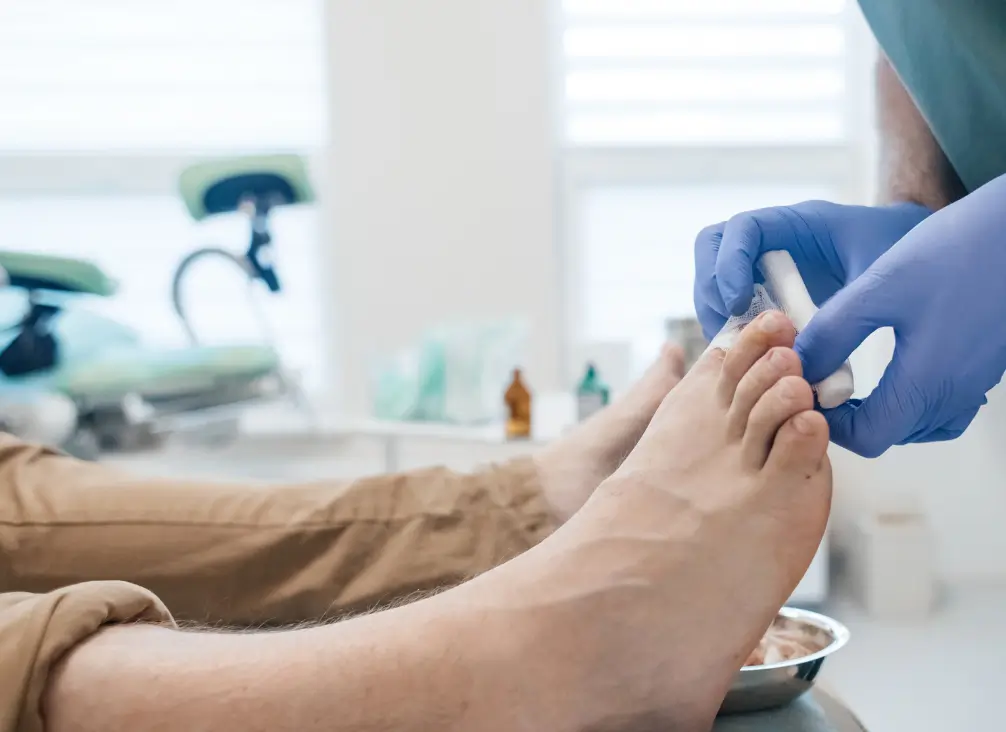 Podiatrist in gloves dressing a toe – professional ingrown toenail care in Brunswick clinic using surgery Onyfix.