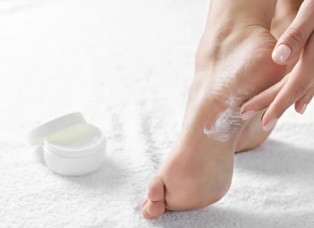 Close-up of woman applying moisturiser to heel – diabetic foot care by podiatry Brunswick.