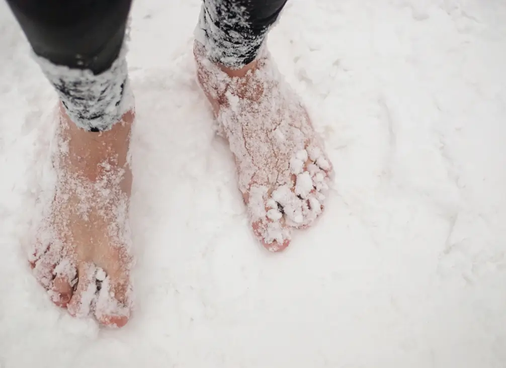 Bare feet covered in snow – podiatry Brunswick care for chilblains and cold-related foot issues.