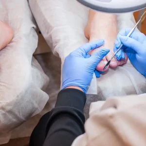 Podiatrist performing a professional foot treatment with sterile tools