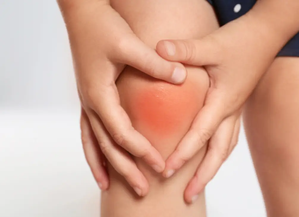 Child holding inflamed knee with visible redness from tibial tubercle apophysitis